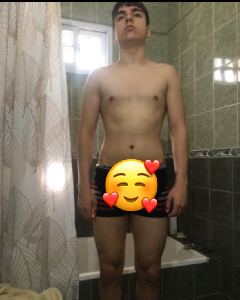 Ignacio antes de comenzar su proceso